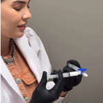 Espuma: Método eficaz e pouco invasivo para tratar vasinhos e varizes de diferentes tamanhos.