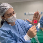 Laser Endovenoso: É um tratamento moderno e minimamente invasivo para varizes de maior calibre. O procedimento é seguro, eficaz e oferece uma recuperação rápida.